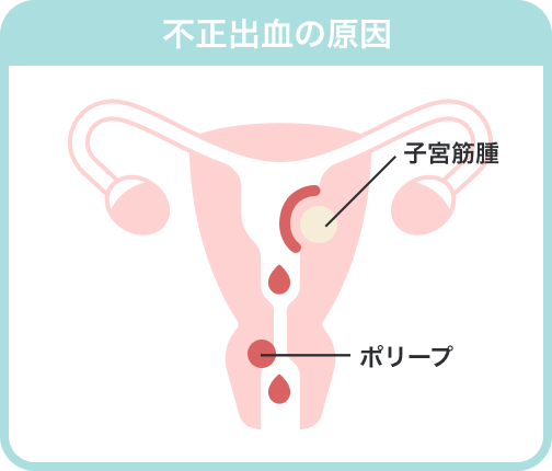 生理じゃないのに血がでるのはなぜ Paircare ペアケア